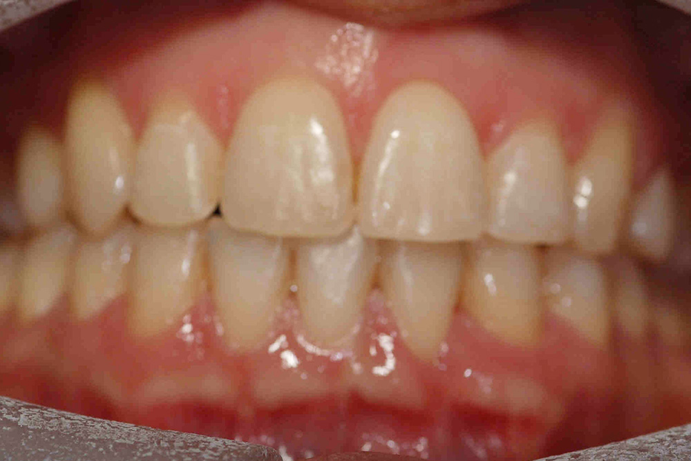 ORTHODONTICS at Refine Specialist Dental Care