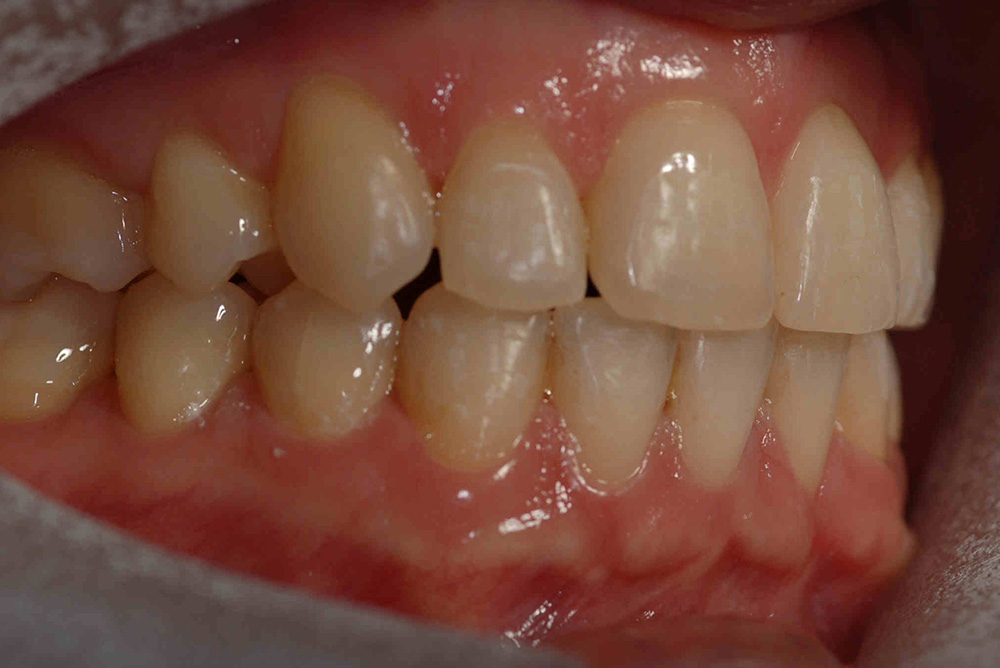 ORTHODONTICS at Refine Specialist Dental Care
