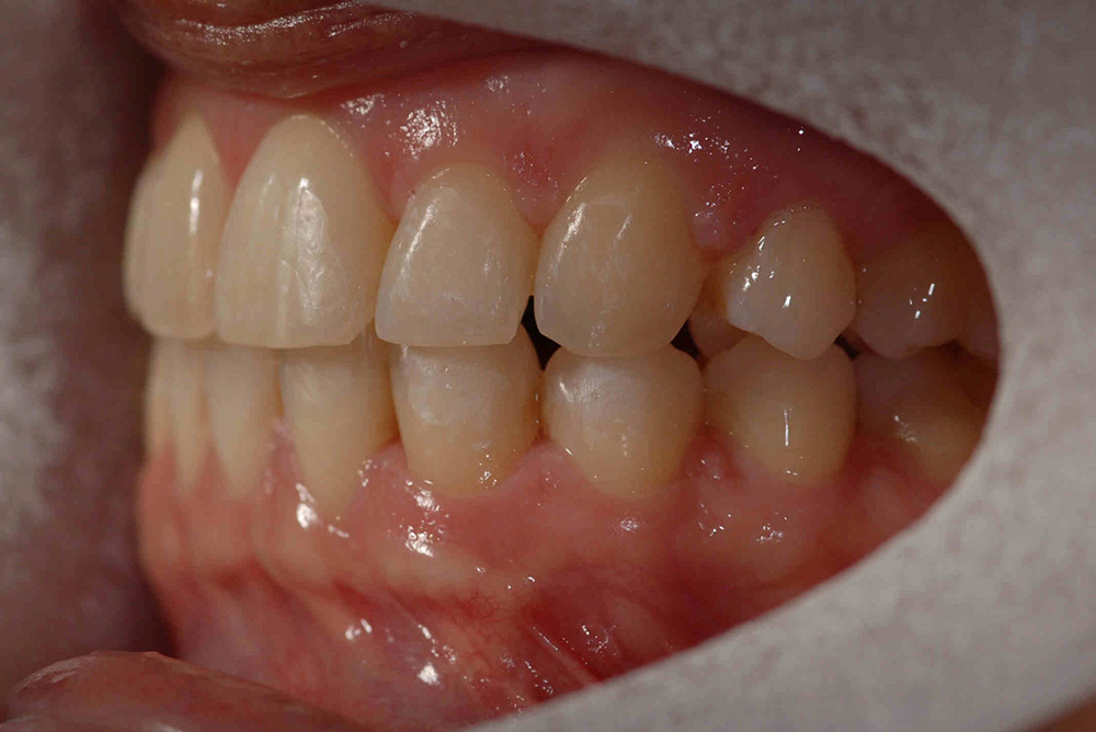 ORTHODONTICS at Refine Specialist Dental Care