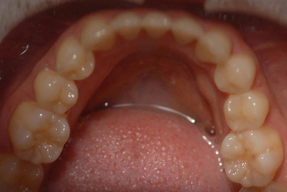 ORTHODONTICS at Refine Specialist Dental Care