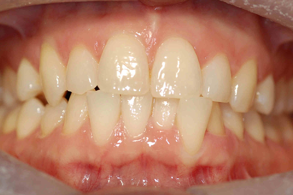 ORTHODONTICS at Refine Specialist Dental Care