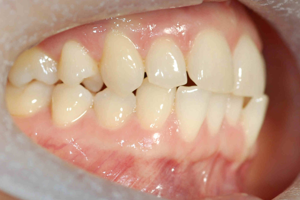 ORTHODONTICS at Refine Specialist Dental Care