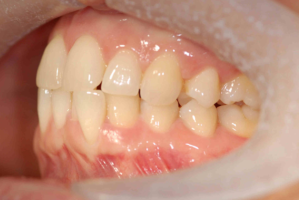 ORTHODONTICS at Refine Specialist Dental Care