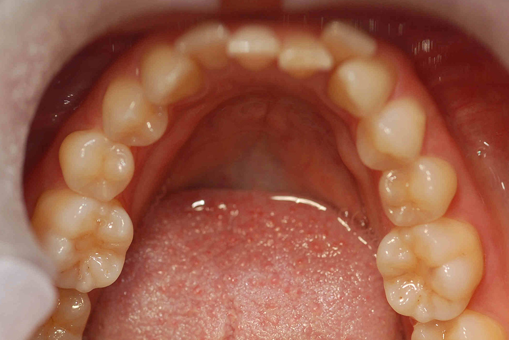ORTHODONTICS at Refine Specialist Dental Care