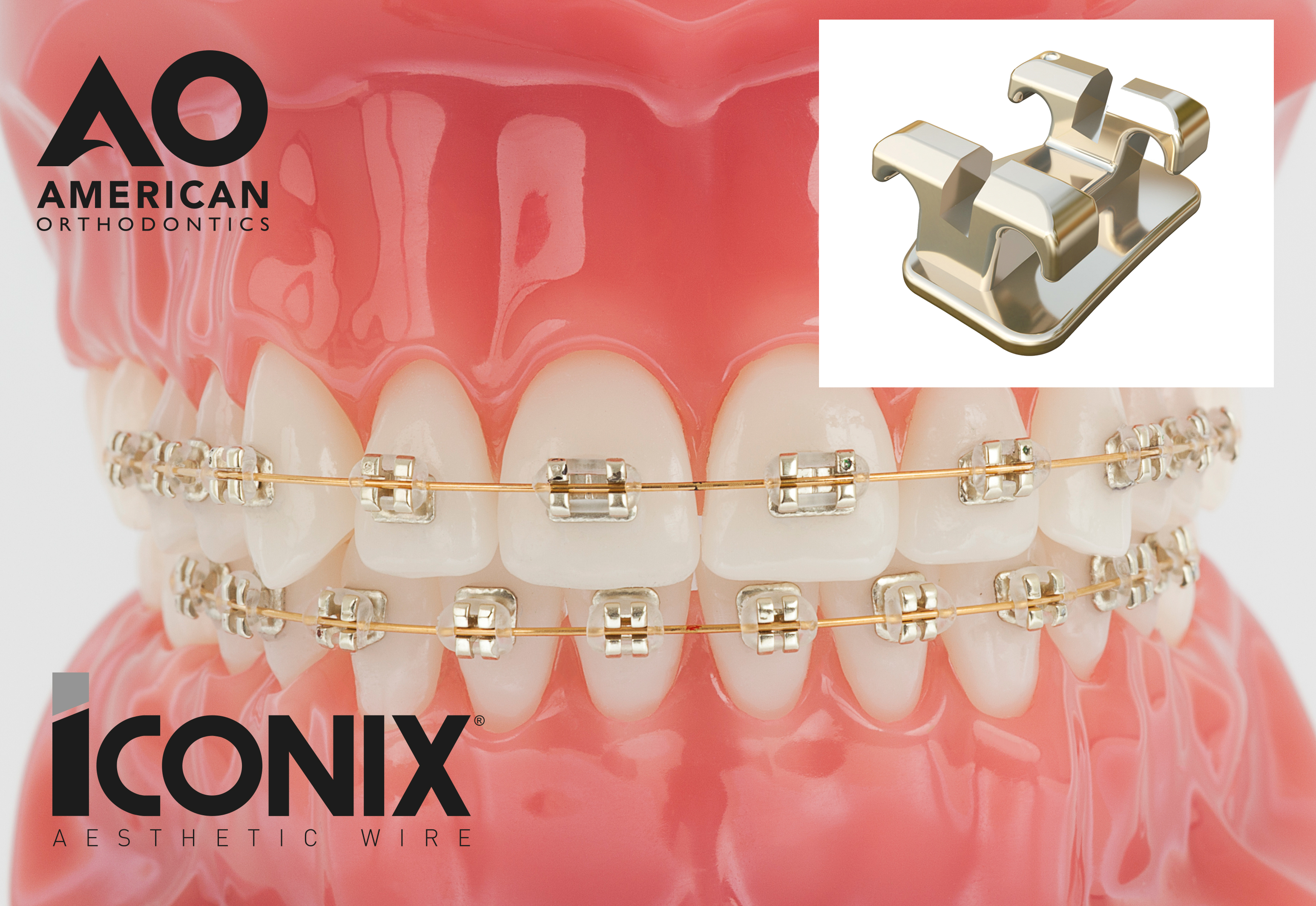 Iconix Braces Orthodontics in North Derbyshire