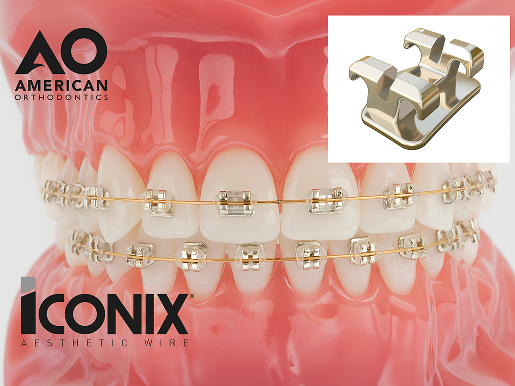 Iconix Braces Orthodontics in North Derbyshire