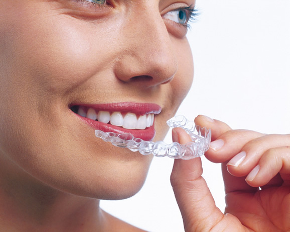 invisalign the clear alternative to braces