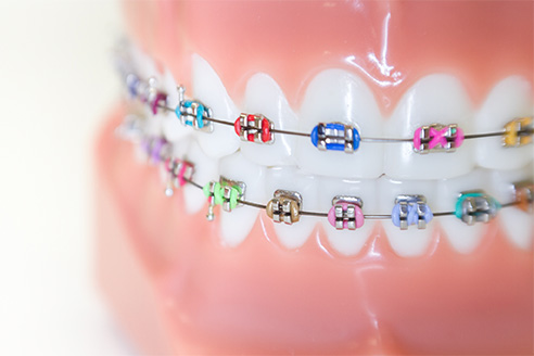 REDUCE WAIT TIMES WITH PRIVATE ORTHODONTIC CARE