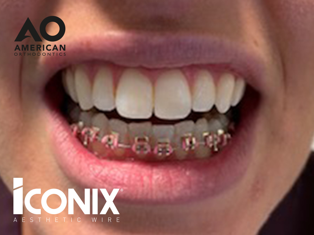Minor Oral Surgery at Refine Specialist Dental Care