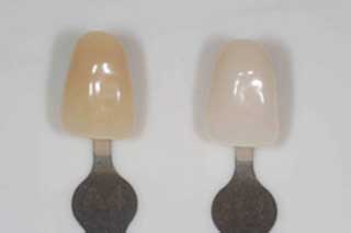 	TEETH WHITENING